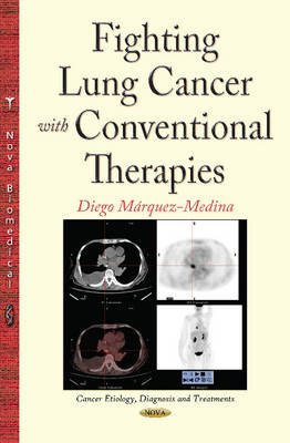 Dieg M Rquez-Medina - Fighting Lung Cancer with Conventional Therapies - 9781634832755 - V9781634832755