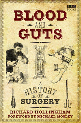 Richard Hollingham - Blood and Guts: A History of Surgery - 9781785940248 - V9781785940248