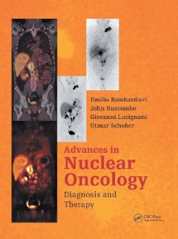 Emilio Bombardieri (Ed.) - Advances in Nuclear Oncology:: Diagnosis and Therapy - 9781841846149 - V9781841846149