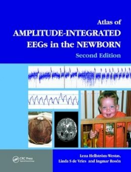 Le Hellstrom-Westas - An Atlas of Amplitude-integrated EEGs in the Newborn - 9781841846491 - V9781841846491
