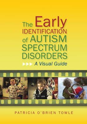 Patricia O´brien O´brien Towle - The Early Identification of Autism Spectrum Disorders: A Visual Guide - 9781849053297 - V9781849053297