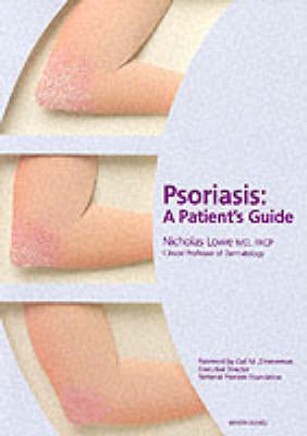 Nicholas J. Lowe (Ed.) - Psoriasis: A Patient's Guide - 9781853175992 - KRF0025576
