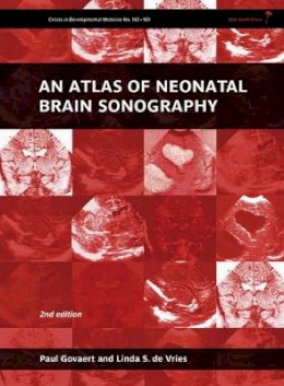 Paul Govaert - An Atlas of Neonatal Brain Sonography - 9781898683568 - V9781898683568