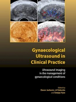 Edited By Davor Jurk - Gynaecological Ultrasound in Clinical Practice: Ultrasound Imaging in the Management of Gynaecological Conditions - 9781904752295 - V9781904752295