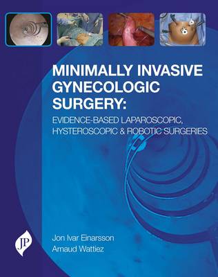 Jon Ivar Einarsson - Minimally Invasive Gynecologic Surgery: Evidence-Based Laparoscopic, Hysteroscopic and Robotic Surgeries - 9781909836099 - V9781909836099