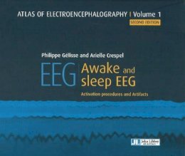 Dr Philippe Gelisse - Atlas of Electroencephalography: Awake and Sleep EEG - 9782742015078 - V9782742015078