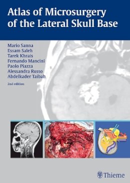 Mario Sanna - Atlas of Microsurgery of the Lateral Skull Base - 9783131010926 - V9783131010926