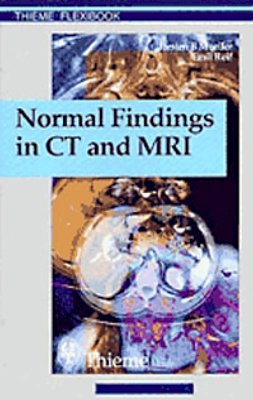 Torsten Bert Moeller - Normal Findings in CT and MRI, A1, print - 9783131165213 - V9783131165213