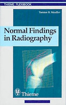 Torsten Bert Moeller - Normal Findings in Radiography - 9783131165312 - V9783131165312