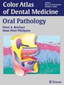 Peter A. Reichart - Oral Pathology - 9783131258816 - V9783131258816