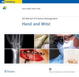 Jesse Jupiter - AO Manual of Fracture Management - Hand and Wrist - 9783131276117 - V9783131276117
