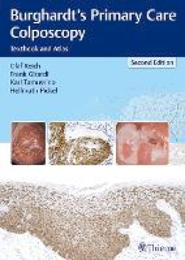 Olaf Reich - Burghardt´s Primary Care Colposcopy: Textbook and Atlas - 9783131307224 - V9783131307224
