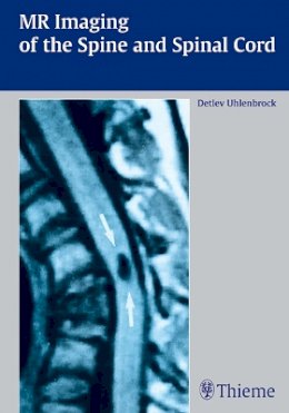 Detlev Uhlenbrock - Mr Imaging of the Spine and Spinal Cord - 9783131309419 - V9783131309419