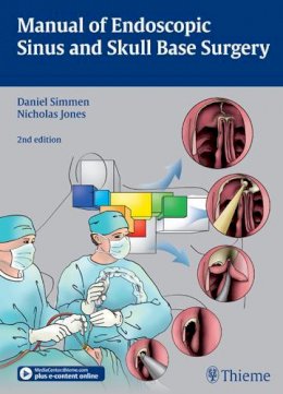 Simmen - Manual Of Endoscopic Sinus And Skul - 9783131309723 - V9783131309723