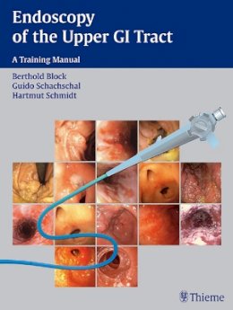 Berthold Block - Endoscopy of the Upper GI Tract: A Training Manual - 9783131367310 - V9783131367310