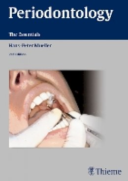 Hans-Peter Müller - Periodontology: The Essentials - 9783131383723 - V9783131383723