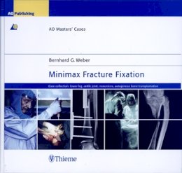 Bernhard G. Weber - Minimax Fracture Fixation: AO Masters´ Cases - 9783131392718 - V9783131392718