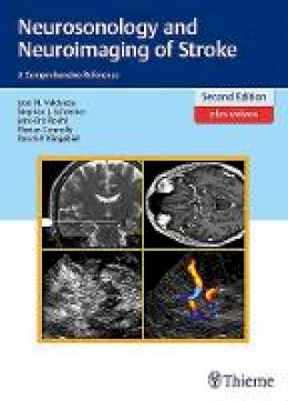 Jose Manuel Valdueza Barrios - Neurosonology and Neuroimaging of Stroke: A Comprehensive Reference - 9783131418722 - V9783131418722