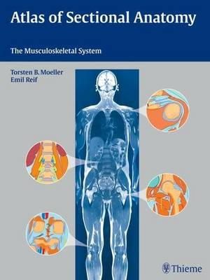 Torsten Bert Moeller - Atlas of Sectional Anatomy - 9783131465412 - V9783131465412