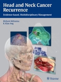 Hisham M. Mehanna - Head and Neck Cancer Recurrence: Evidence-based, Multidisciplinary Management - 9783131473912 - V9783131473912