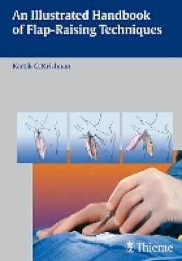 Kartik G. Krishnan - An Illustrated Handbook of Flap-raising Techniques - 9783131477613 - V9783131477613
