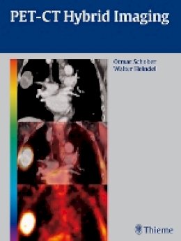 Otmar Schober - PET-CT Hybrid Imaging - 9783131488619 - V9783131488619