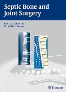 Reinhard Schnettler - Septic Bone and Joint Surgery - 9783131490315 - V9783131490315