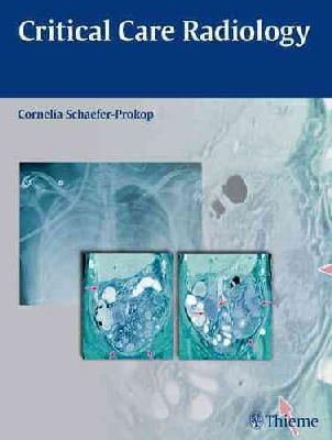 Cornelia Schaefer-Prokop - Critical Care Radiology - 9783131500519 - V9783131500519