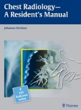 Johannes Kirchner - Chest Radiology: A Resident's Manual - 9783131538710 - V9783131538710