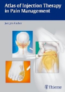 Jürgen Fischer - Atlas of Injection Therapy in Pain Management - 9783131543011 - V9783131543011