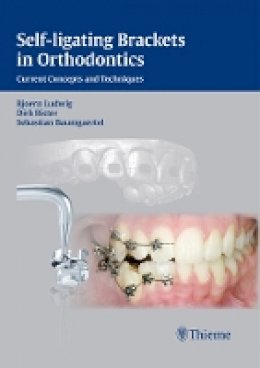 Dirk Bister - Self-ligating Brackets in Orthodontics - 9783131547019 - V9783131547019