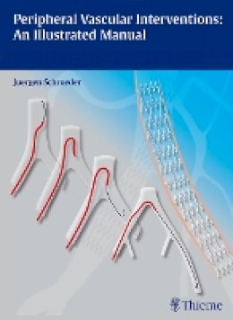 Jürgen Schröder - Peripheral Vascular Interventions: An Illustrated Manual - 9783131697516 - V9783131697516