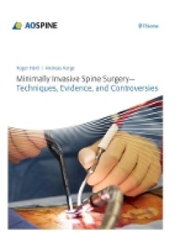 Roger Haertl - Minimally Invasive Spine Surgery - 9783131723819 - V9783131723819