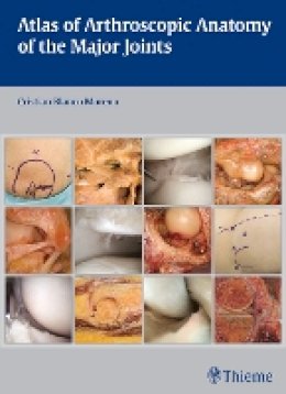 Cristian Blanco Moreno - Atlas of Arthroscopic Anatomy of Major Joints - 9783132037915 - V9783132037915