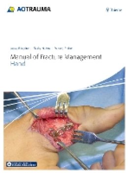 Jupiter - Manual of Fracture Management - Hand - 9783132215818 - V9783132215818