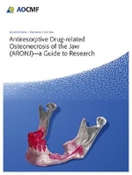 Kenneth E. Fleisher - Antiresorptive Drug-Related Osteonecrosis of the Jaw (Aronj) - A Guide to Research - 9783132412705 - V9783132412705