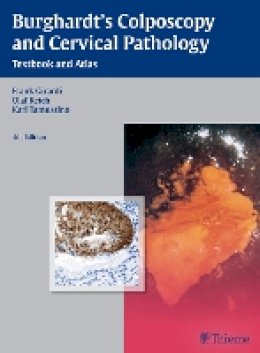 Frank Girardi - Burghardt's Colposcopy and Cervical Pathology - 9783136599044 - V9783136599044