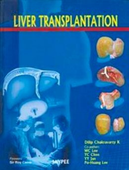Dilip Kumar Chakravarty - Liver Transplantation - 9788184487701 - V9788184487701
