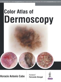 Horacio Cabo - Color Atlas of Dermoscopy - 9789386056306 - V9789386056306