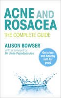 Alison Bowser - Acne and Rosacea: The Complete Guide - 9780091929701 - V9780091929701