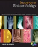 Paolo Pozzilli - Imaging in Endocrinology - 9780470656273 - V9780470656273