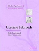 Togas Tulandi (Ed.) - Uterine Fibroids: Embolization and other Treatments - 9780521819381 - V9780521819381