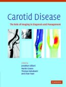 Jonathan Gillard (Ed.) - Carotid Disease: The Role of Imaging in Diagnosis and Management - 9780521862264 - V9780521862264