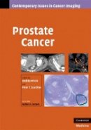 Edited By Hedvig Hri - Prostate Cancer - 9780521887045 - V9780521887045