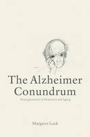 Margaret M. Lock - The Alzheimer Conundrum: Entanglements of Dementia and Aging - 9780691168470 - V9780691168470