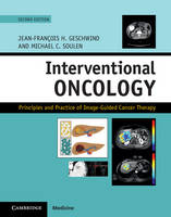 Edited By Jean-Franc - Interventional Oncology: Principles and Practice of Image-Guided Cancer Therapy - 9781107043473 - V9781107043473