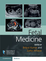 Bid (Ed) Kumar - Royal College of Obstetricians and Gynaecologists Advanced Skills: Fetal Medicine - 9781107064348 - V9781107064348