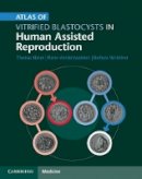 Thomas Ebner - Atlas of Vitrified Blastocysts in Human Assisted Reproduction - 9781107074095 - V9781107074095