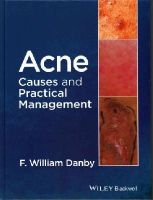 F. William Danby - Acne: Causes and Practical Management - 9781118232774 - V9781118232774