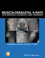 Andrew Brown - Musculoskeletal X-Rays for Medical Students and Trainees - 9781118458730 - V9781118458730